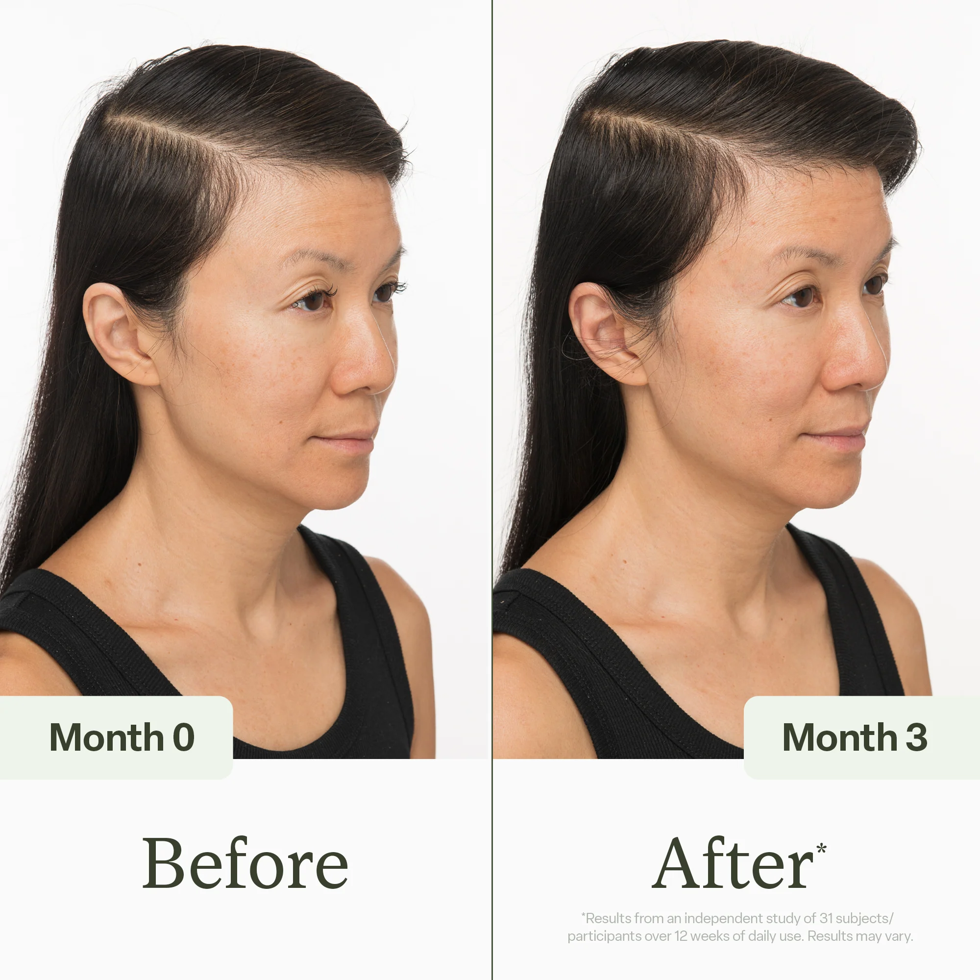 30ml Scalp Serum - Image 4